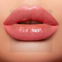Russian Lip Augmentation (Droplet)