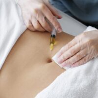 Fat Dissolve Injections